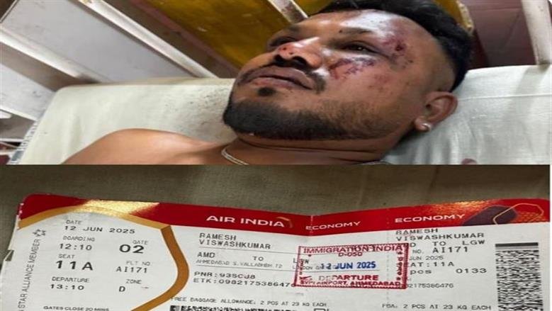 طفلة تفقد عينيها بضربة طائشة ورئيس الوزراء يوجه بعالجها فورا