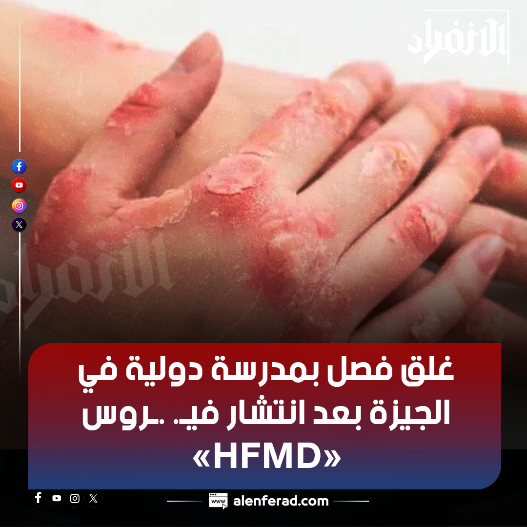فيروس اليد والفم والقدم HFMD